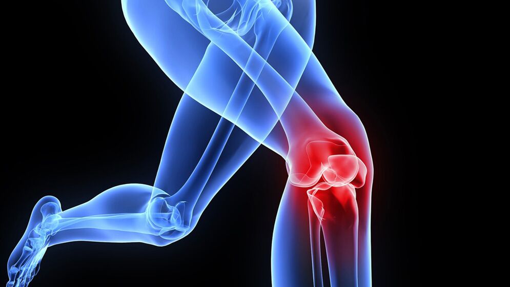 problemas cos xeonllos debido á artrose